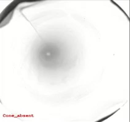 Missing cone defect